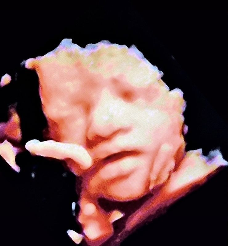 3D ultrasound input